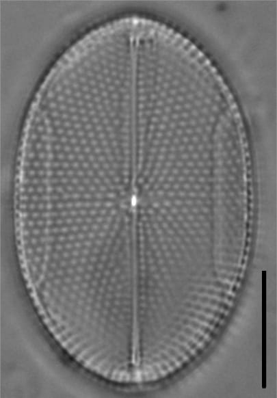 Mastogloia binotata LM2