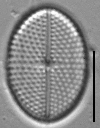 Mastogloia binotata LM5