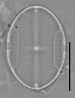 Mastogloia binotata LM6