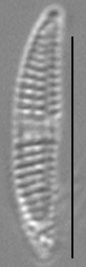 Medlinella amphoroidea LM1
