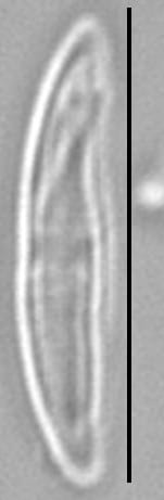 Medlinella amphoroidea LM2