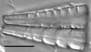 Meridion Girdle View Edit