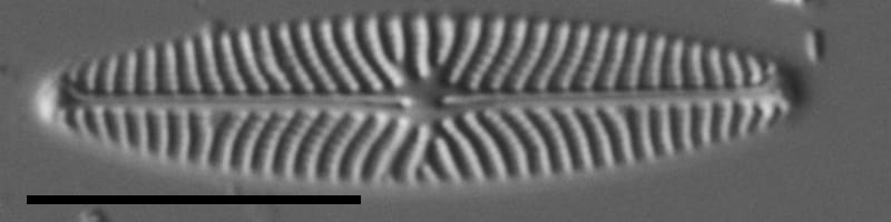 Navicula eileeniae LM6