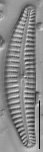 Cymbella excisiformis LM4