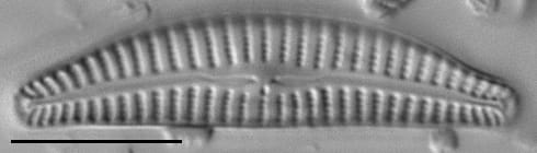 Cymbella excisiformis LM4