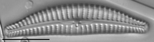 Cymbella excisiformis LM3