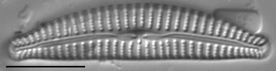 Cymbella excisiformis LM2