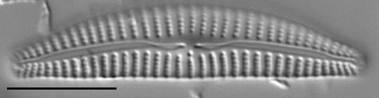 Cymbella excisiformis LM1