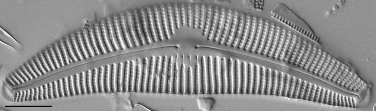 Cymbella proxima LM5