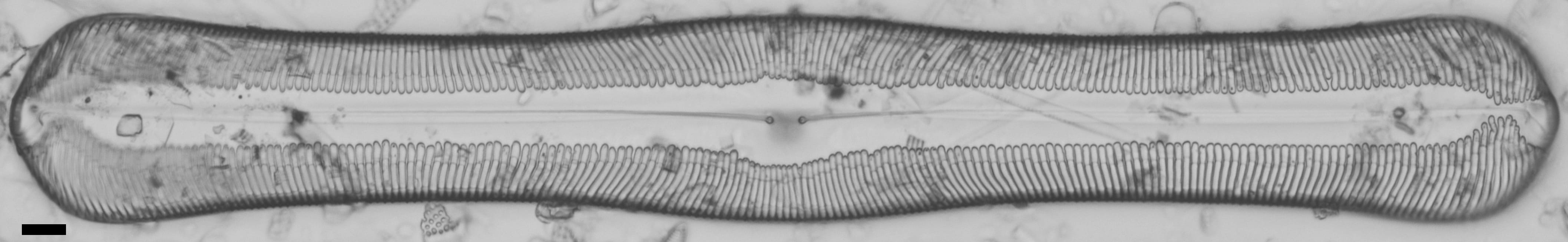 Pinnularia alabamae LM5