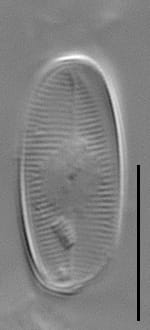 Eucocconeis alpestris LM4