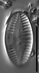 Platessa strelnikovae LM3