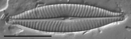 Navicula cryptocephala LM5