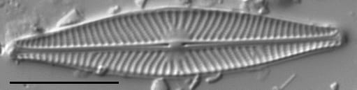 Navicula cryptocephala LM4