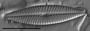 Navicula cryptocephala LM3