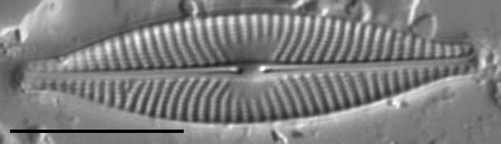 Navicula cryptocephala LM2