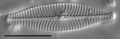 Navicula cryptocephala LM1