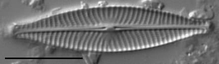 Navicula cryptocephala LM7