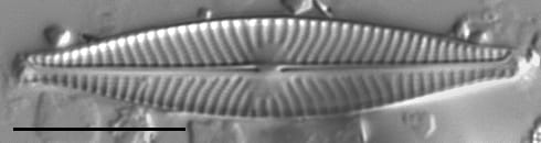 Navicula cryptocephala LM6