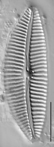 Cymbella turgidula LM4