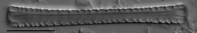 Diatoma tenuis LM5