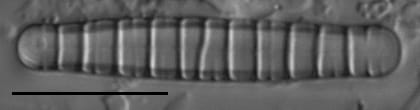 Diatoma tenuis LM3