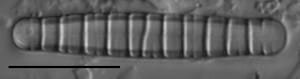 Diatoma tenuis LM3