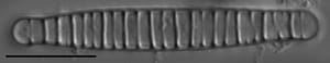 Diatoma tenuis LM1