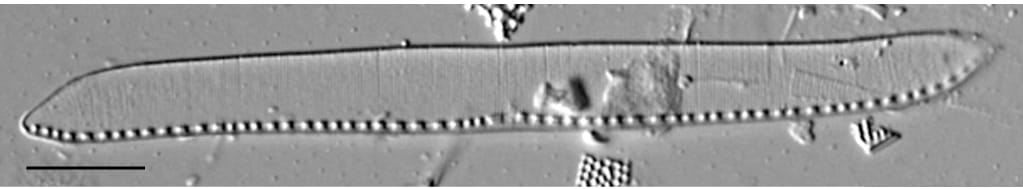 Nitzschia kurzeana LM2