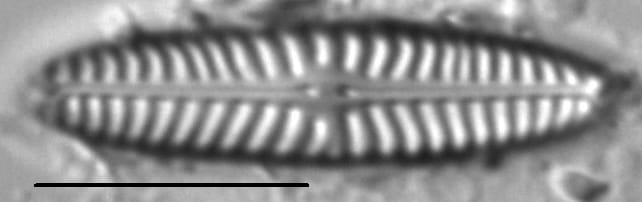 Navicula cincta LM3