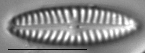 Navicula cincta LM1