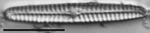 Navicula pseudotenelloides LM5