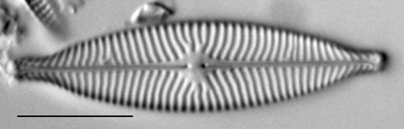 Navicula capitatoradiata LM5