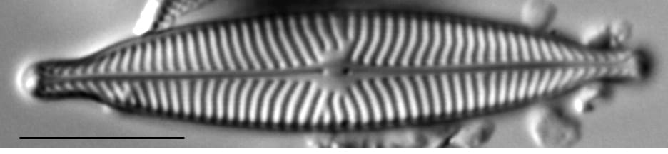 Navicula capitatoradiata LM2