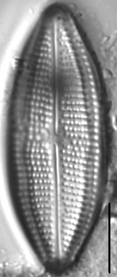 Neidium distinctepunctatum LM2