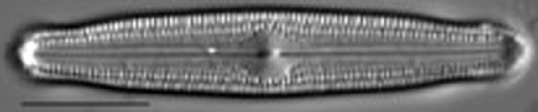 Neidiopsis hamiltonii LM1