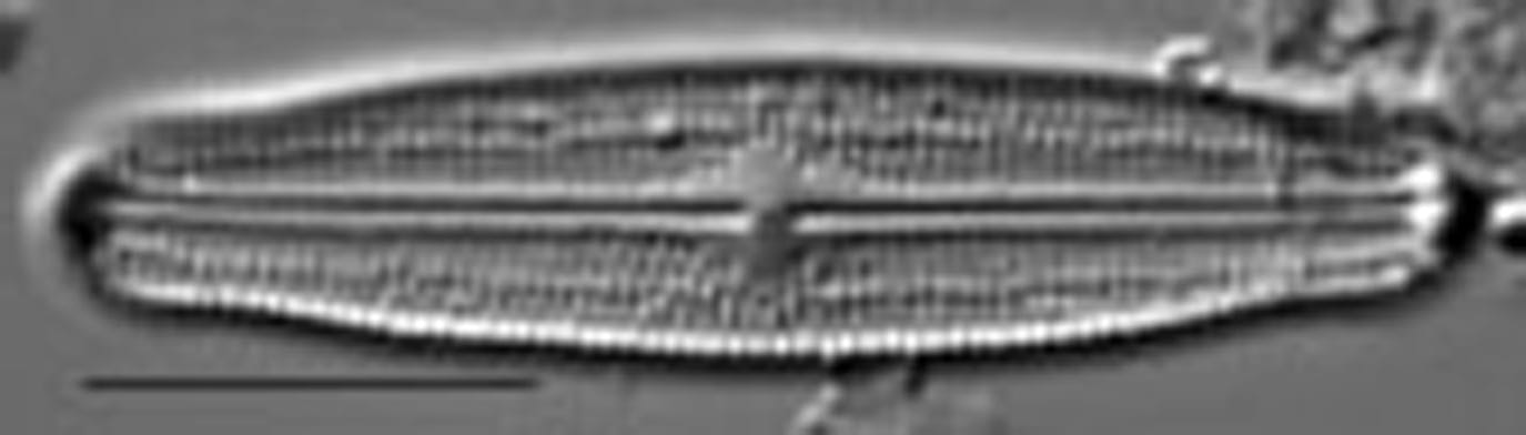 Neidiopsis hamiltonii LM3