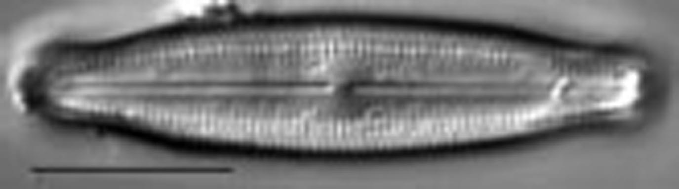 Neidiopsis hamiltonii LM2