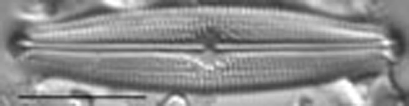 Neidiopsis hamiltonii LM4