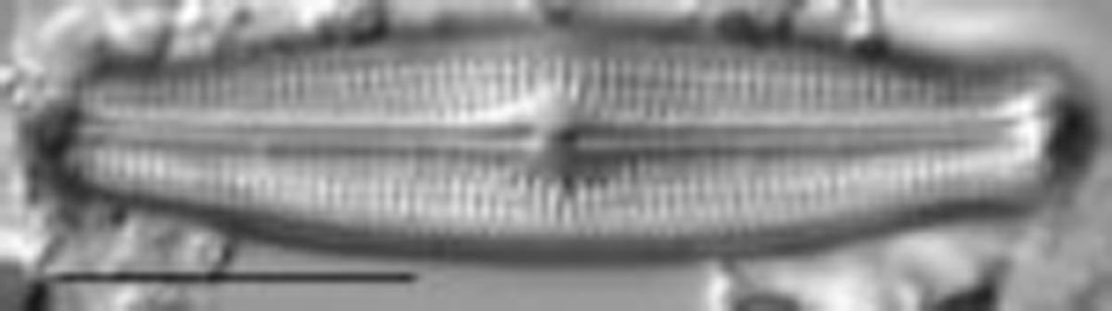 Neidiopsis hamiltonii LM5