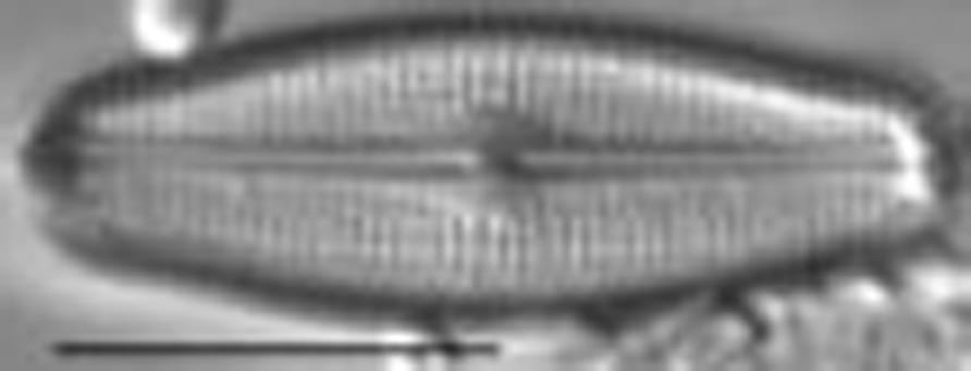 Neidiopsis hamiltonii LM7