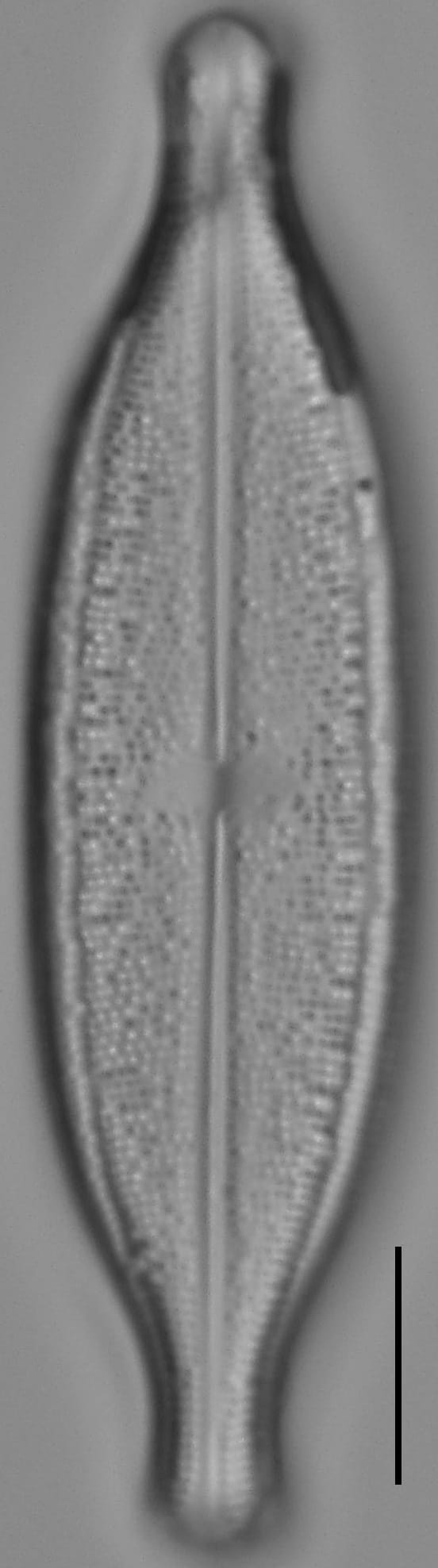Neidium Productum Lm2B