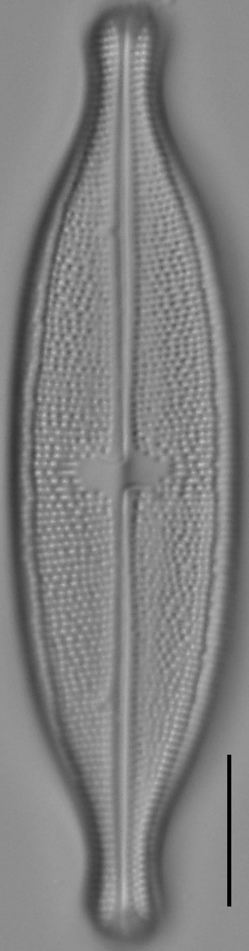 Neidium Productum Lm3B
