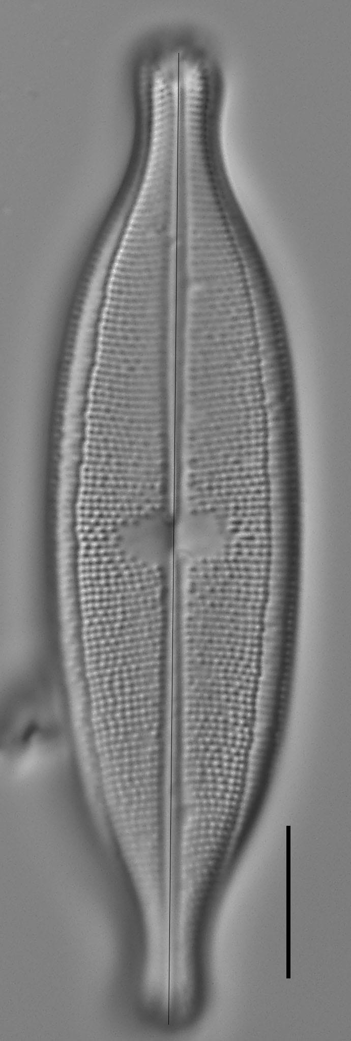 Neidium Productum Lm4