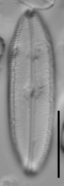 Neidium hercynicum LM7