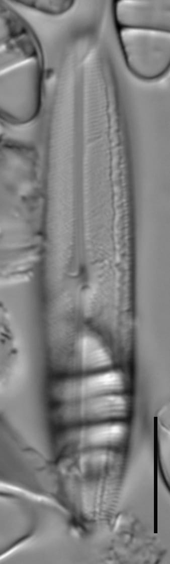 Neidium hercynicum LM1