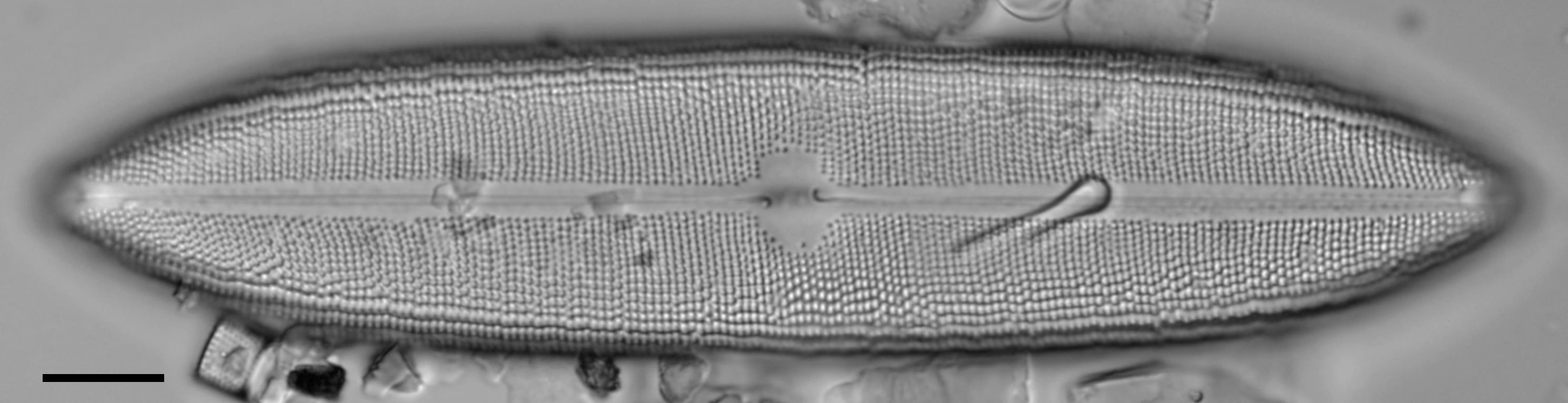 Neidium amphigomphus LM5