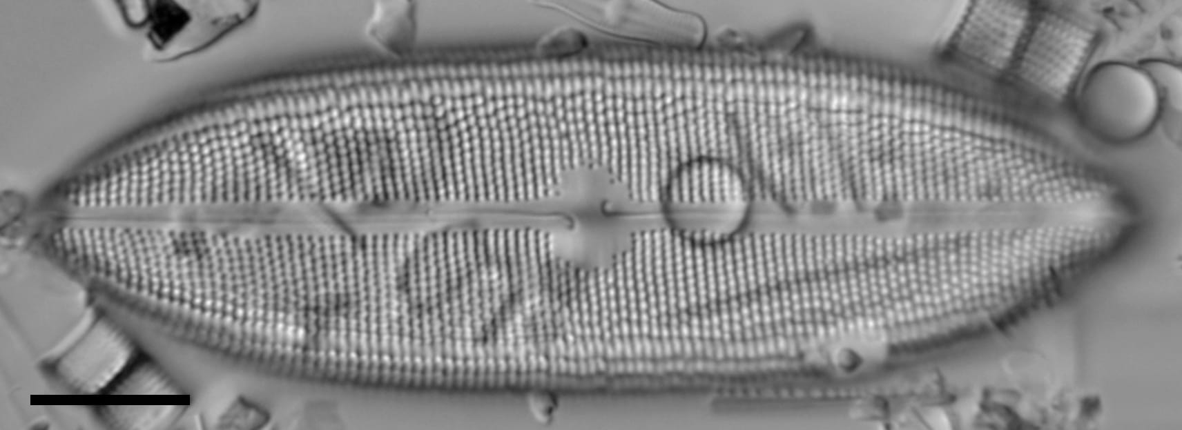 Neidium amphigomphus LM2