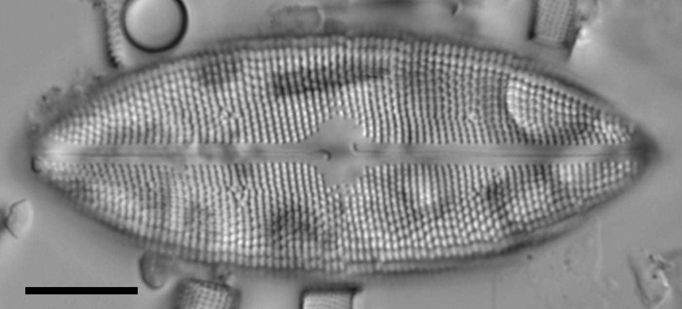 Neidium amphigomphus LM1