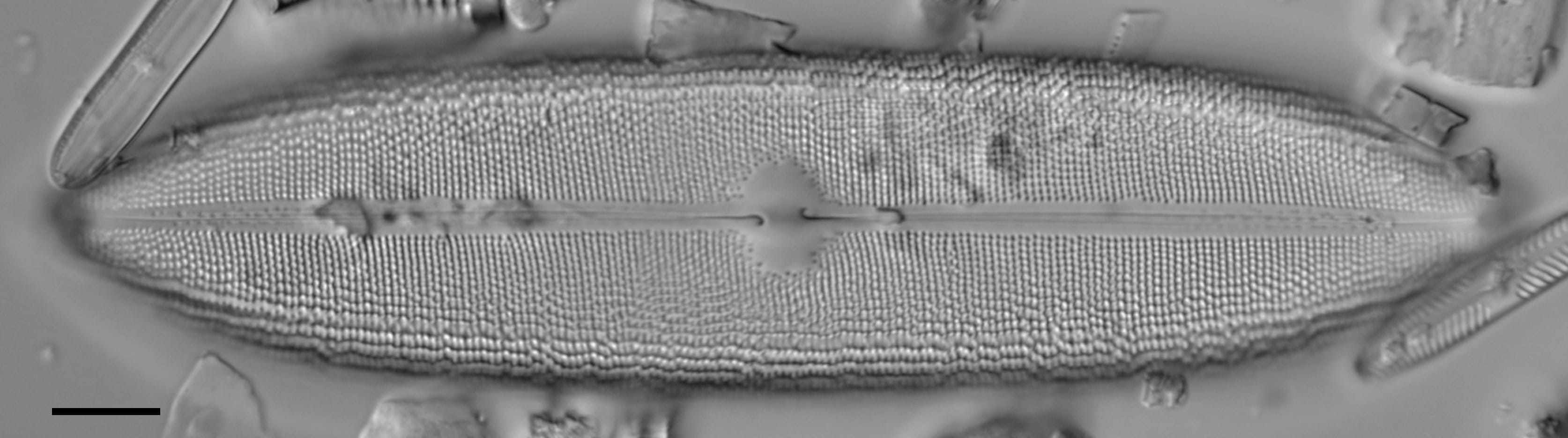 Neidium amphigomphus LM6